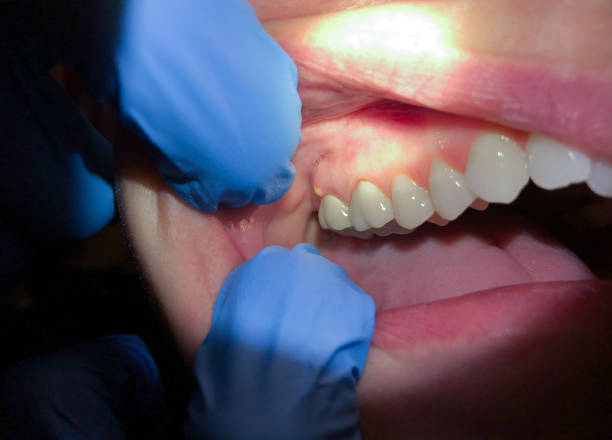 Best Broken or Cracked Tooth Emergency Dentist in Bethlehem, NC