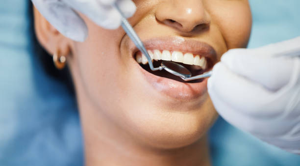 Best Emergency Dentist for Knocked-Out Tooth in Bethlehem, NC